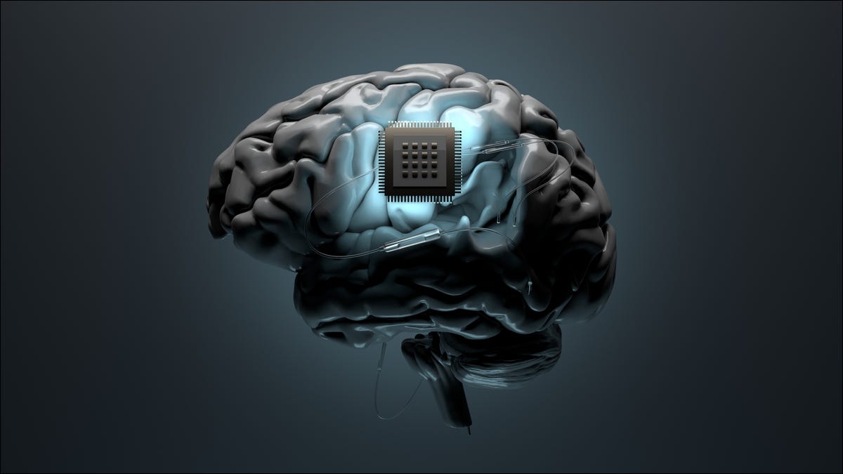 脑移植的未来几乎就在这里。你准备好了吗？